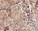 REST Antibody in Immunohistochemistry (Paraffin) (IHC (P))