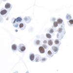 HIF-1 alpha Antibody in Immunocytochemistry (ICC/IF)