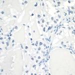 HIF-1 alpha Antibody in Immunohistochemistry (Paraffin) (IHC (P))