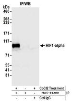 HIF-1 alpha Antibody in Immunoprecipitation (IP)