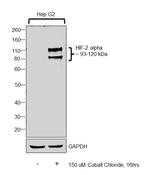 HIF-2 alpha Antibody in Western Blot (WB)