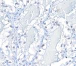 HIF-2 alpha Antibody in Immunohistochemistry (Paraffin) (IHC (P))