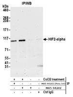 HIF-2 alpha Antibody in Immunoprecipitation (IP)