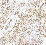 BRD4 Antibody in Immunohistochemistry (Paraffin) (IHC (P))