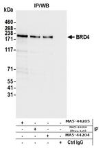 BRD4 Antibody in Immunoprecipitation (IP)