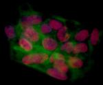 BRD4 Antibody in Immunocytochemistry (ICC/IF)