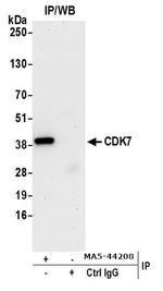 CDK7 Antibody in Immunoprecipitation (IP)