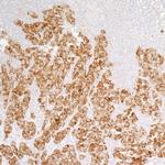 PTPN12 Antibody in Immunohistochemistry (Paraffin) (IHC (P))