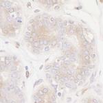 PTPN12 Antibody in Immunohistochemistry (Paraffin) (IHC (P))