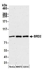 BRD2 Antibody in Western Blot (WB)