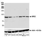 BRD2 Antibody in Western Blot (WB)