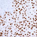 53BP1 Antibody in Immunohistochemistry (Paraffin) (IHC (P))