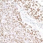 TRIM28 Antibody in Immunohistochemistry (Paraffin) (IHC (P))