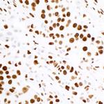 TRIM28 Antibody in Immunohistochemistry (Paraffin) (IHC (P))