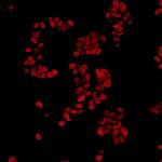 FUS Antibody in Immunocytochemistry (ICC/IF)