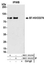 B7-H3 (CD276) Antibody in Immunoprecipitation (IP)