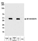 B7-H3 (CD276) Antibody in Western Blot (WB)