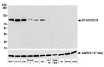 B7-H3 (CD276) Antibody in Western Blot (WB)