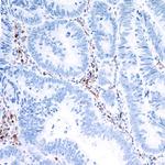 IDO1 Antibody in Immunohistochemistry (Paraffin) (IHC (P))