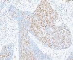 CTCF Antibody in Immunohistochemistry (Paraffin) (IHC (P))