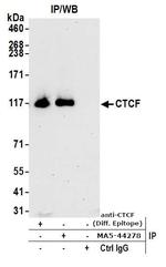 CTCF Antibody in Immunoprecipitation (IP)