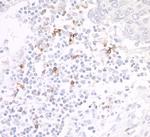 OX40 (CD134) Antibody in Immunohistochemistry (Paraffin) (IHC (P))