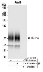 B7-H4 Antibody in Immunoprecipitation (IP)