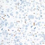 c-MAF Antibody in Immunohistochemistry (Paraffin) (IHC (P))