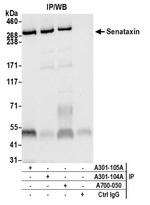 SETX Antibody in Immunoprecipitation (IP)