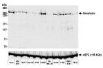 SETX Antibody in Western Blot (WB)