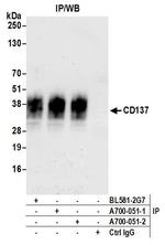 CD137 (4-1BB) Antibody in Immunoprecipitation (IP)