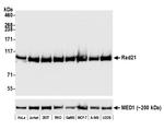 RAD21 Antibody in Western Blot (WB)