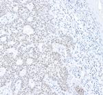 Phospho-gamma-H2AX (Ser139) Antibody in Immunohistochemistry (Paraffin) (IHC (P))