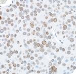 Phospho-gamma-H2AX (Ser139) Antibody in Immunohistochemistry (Paraffin) (IHC (P))