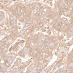 beta Actin Antibody in Immunohistochemistry (Paraffin) (IHC (P))