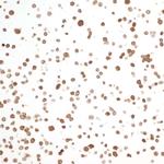 NAMPT Antibody in Immunocytochemistry (ICC/IF)