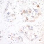 NAMPT Antibody in Immunohistochemistry (Paraffin) (IHC (P))