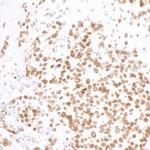 Histone H2A.X Antibody in Immunohistochemistry (Paraffin) (IHC (P))