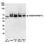 TNFRSF14 (HVEM) Antibody in Western Blot (WB)