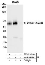 CD226 (DNAM-1) Antibody in Immunoprecipitation (IP)