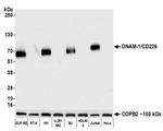 CD226 (DNAM-1) Antibody in Western Blot (WB)