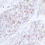 CD96 Antibody in Immunohistochemistry (Paraffin) (IHC (P))
