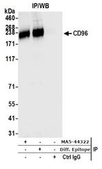 CD96 Antibody in Immunoprecipitation (IP)