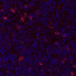 GITR (TNFRSF18) Antibody in Immunohistochemistry (Paraffin) (IHC (P))