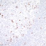 GITR (TNFRSF18) Antibody in Immunohistochemistry (Paraffin) (IHC (P))