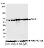 TFEB Antibody in Western Blot (WB)