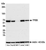 TFEB Antibody in Western Blot (WB)