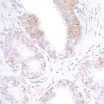 CD112 (Nectin-2) Antibody in Immunohistochemistry (Paraffin) (IHC (P))