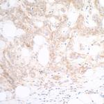 CD112 (Nectin-2) Antibody in Immunohistochemistry (Paraffin) (IHC (P))