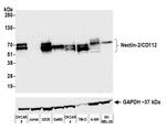 CD112 (Nectin-2) Antibody in Western Blot (WB)